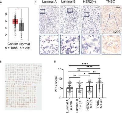 Protein Tyrosine Kinase 7 Regulates EGFR/Akt Signaling Pathway and Correlates With Malignant Progression in Triple-Negative Breast Cancer